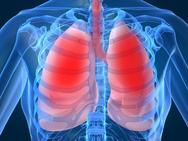 Infections pulmonaires (pneumonies) : remèdes naturels