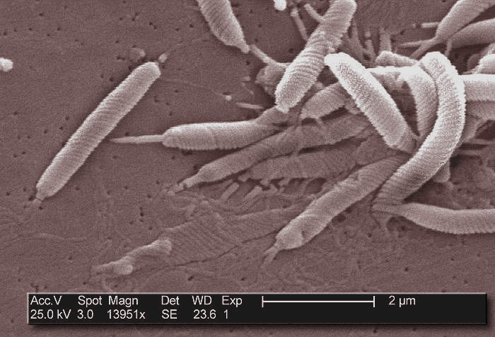 Tout savoir sur Helicobacter pylori